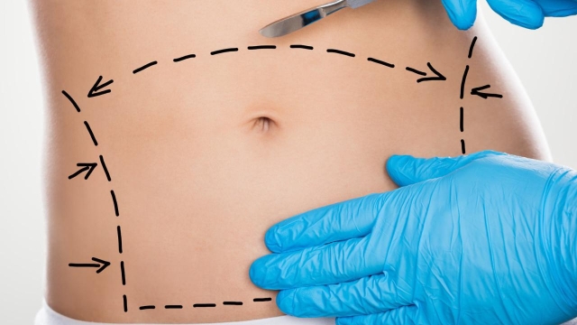 Sculpting Bodies: Unveiling the Secrets of Liposuction