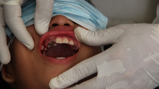 Overview of Cosmetic Dentistry Options