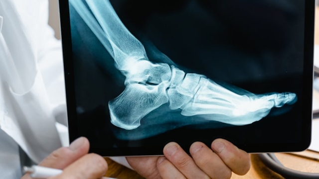 Advancements in Red Light Therapy Technology